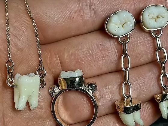 Jeweller in Australia makes necklaces, rings from teeth of dead loved ones