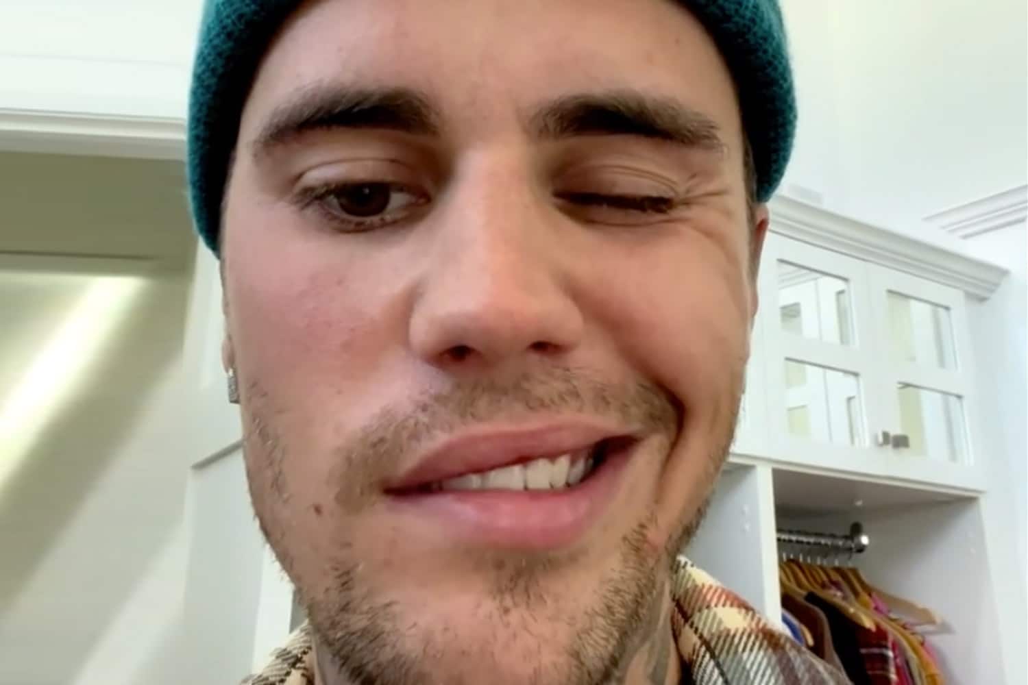 VIDEO: Justin Bieber reveals he is suffering from facial paralysis