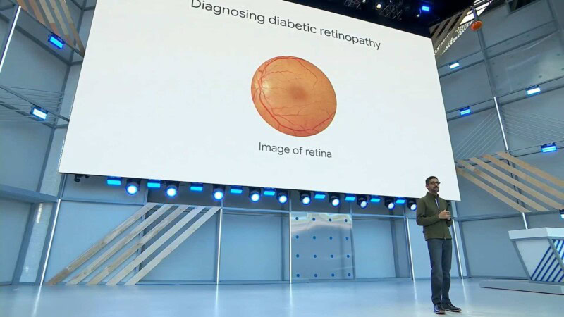 Google’s healthcare tech uses AI to predict heart disease with just an eye scan