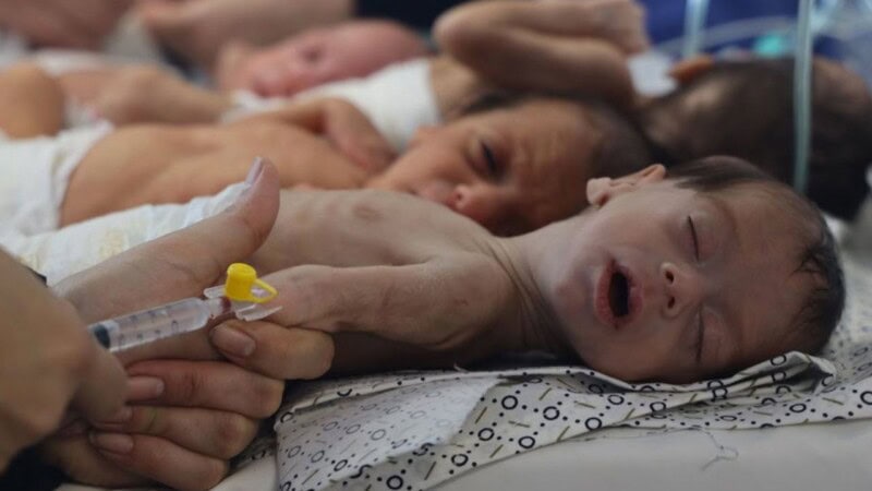 In Gaza, there are no more ‘normal-sized babies’: UN official