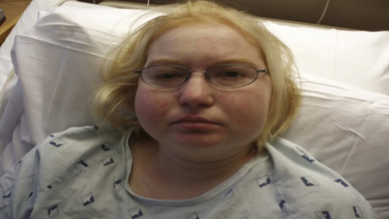 Cushing Syndrome: Diagnosis, New Research and Treatment Advances by Amy Schumer