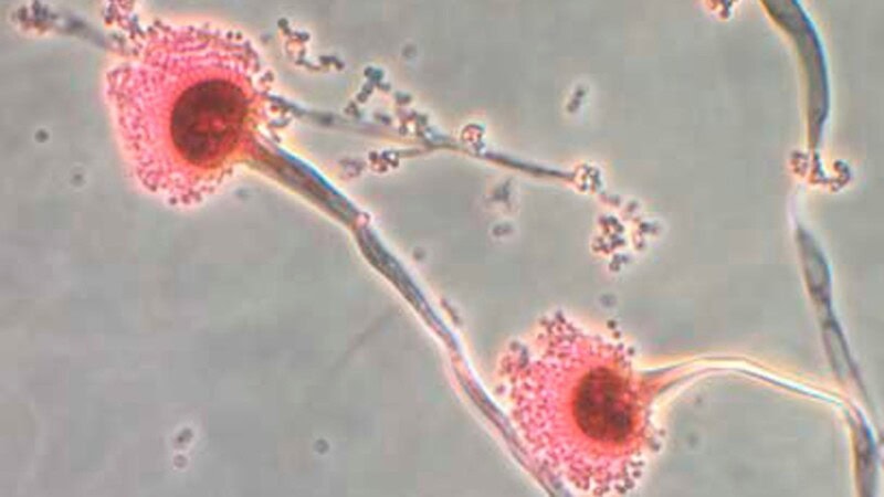 Killer Fungus UK: A Growing Threat You Need to Know