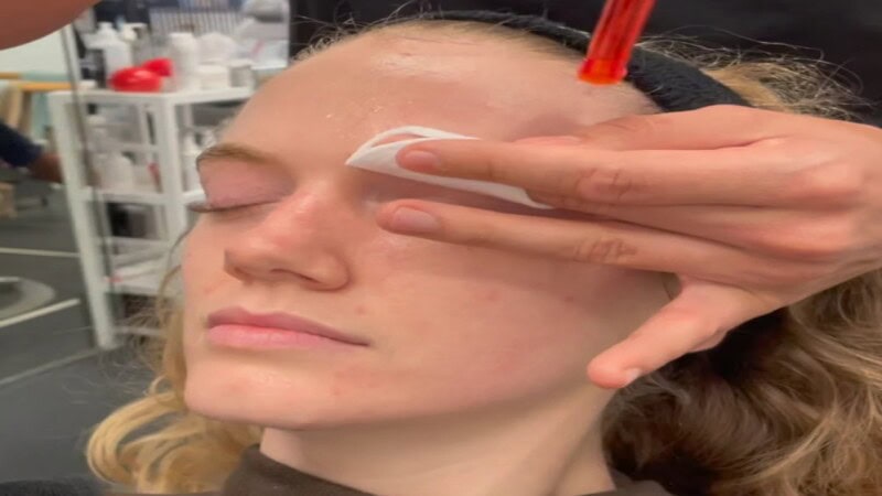 How to Get Clear Skin Naturally at Home