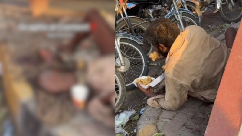Homeless man infested with maggots rescued near Mayo Hospital