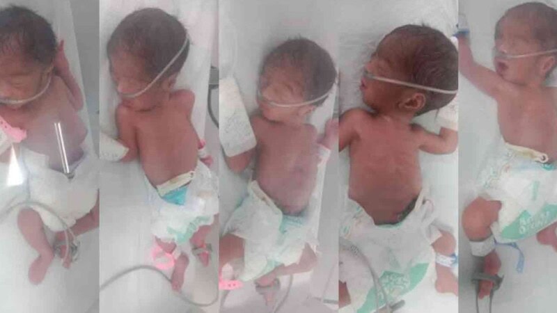 Karachi mom creates rare birth record