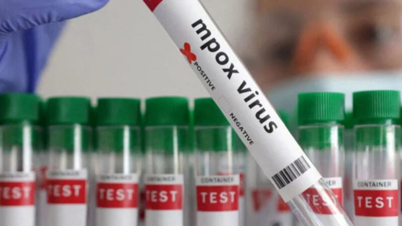 Lahore reports first locally-transmitted mpox case