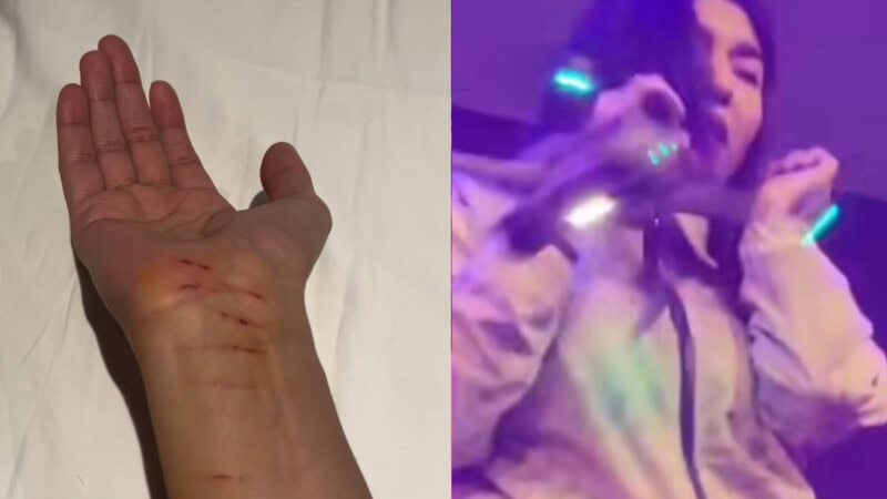 Shae Gill updates fans after drone injury at Islamabad concert