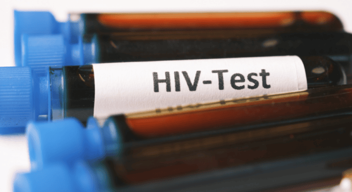 Lahore tops list as Punjab records 9,634 new HIV cases in seven months