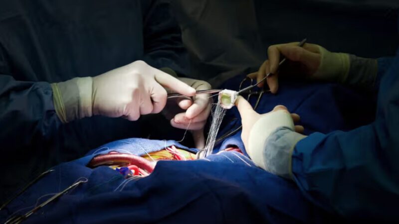 Scissors left inside patient’s chest during open-heart surgery at Faisalabad hospital