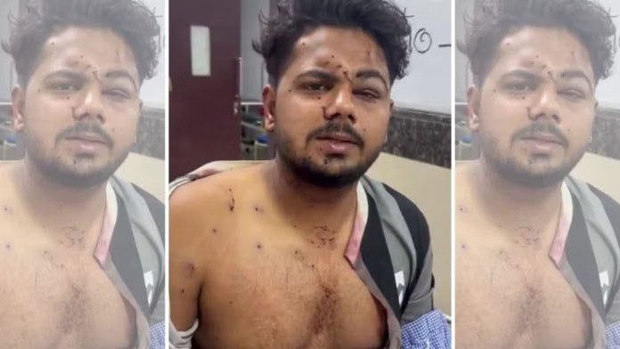 Delhi police deny using pellet guns at Jantar Mantar; videos, medical reports contradict claims