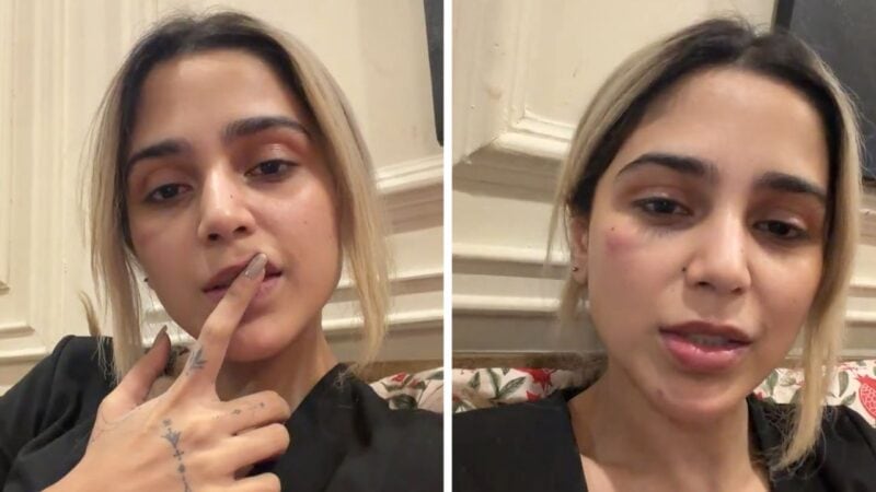 ‘Slammed my face into a glass door’: Aima Baig says bruise on face not from domestic violence