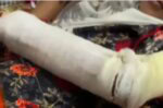 Lahore girl, 10, suffers broken arm after ‘being beaten’ for breaking glass tumbler