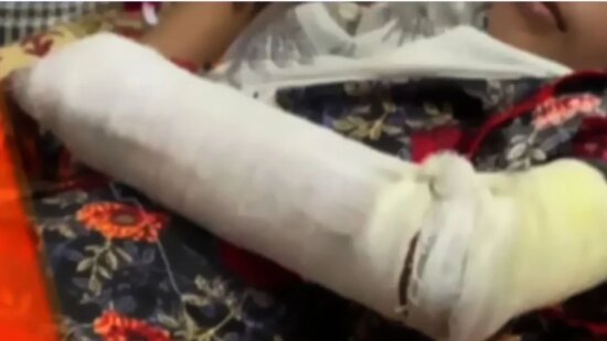 Lahore girl, 10, suffers broken arm after ‘being beaten’ for breaking glass tumbler