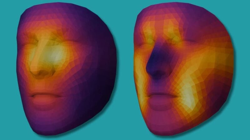 New AI tool predicts cancer survival from a single photograph of patient’s face
